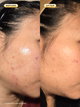 Before and after customer use 24 Carrot Retinal