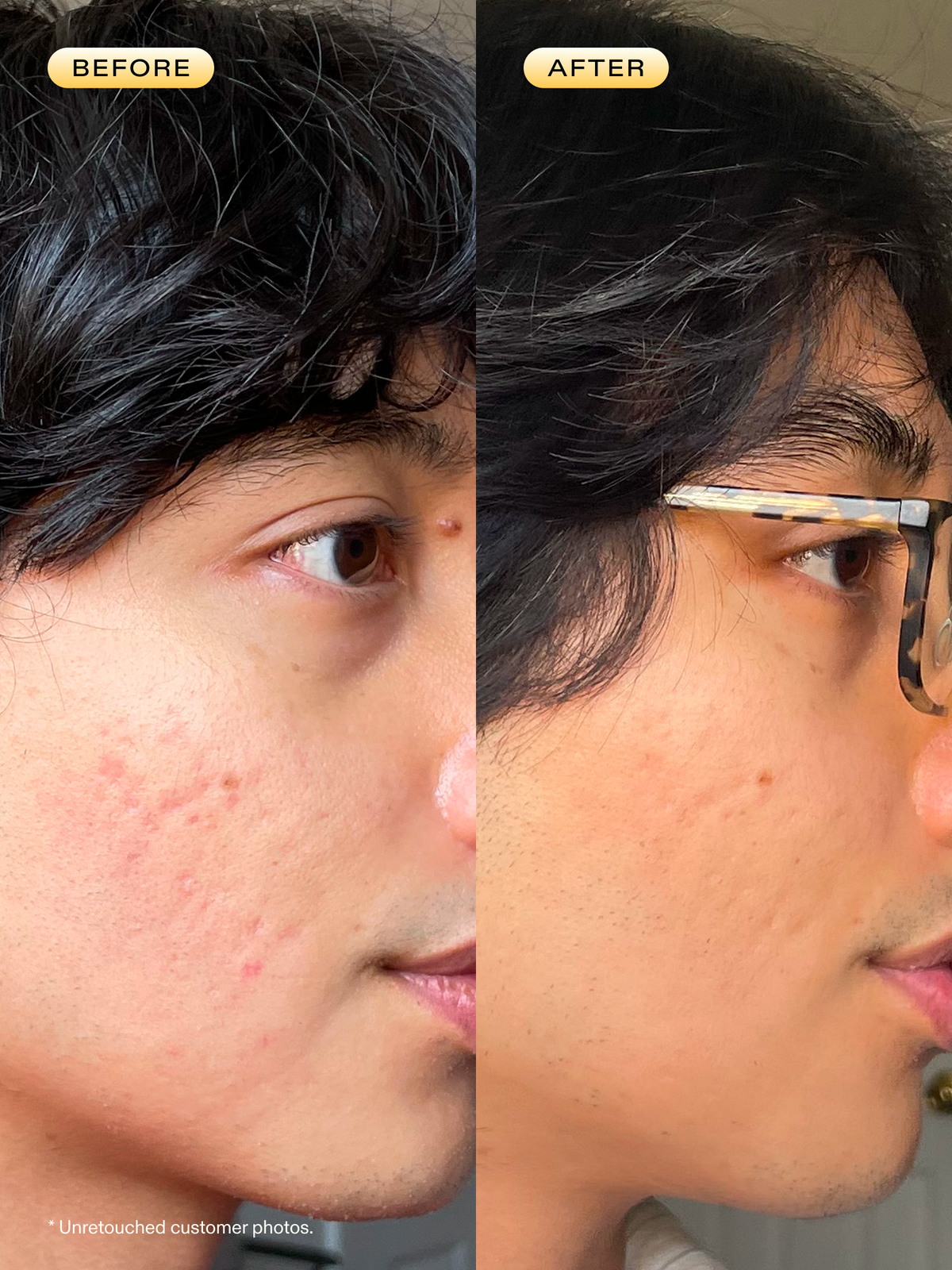 Unretouched customer photos before and after using 24 Carrot Retinal