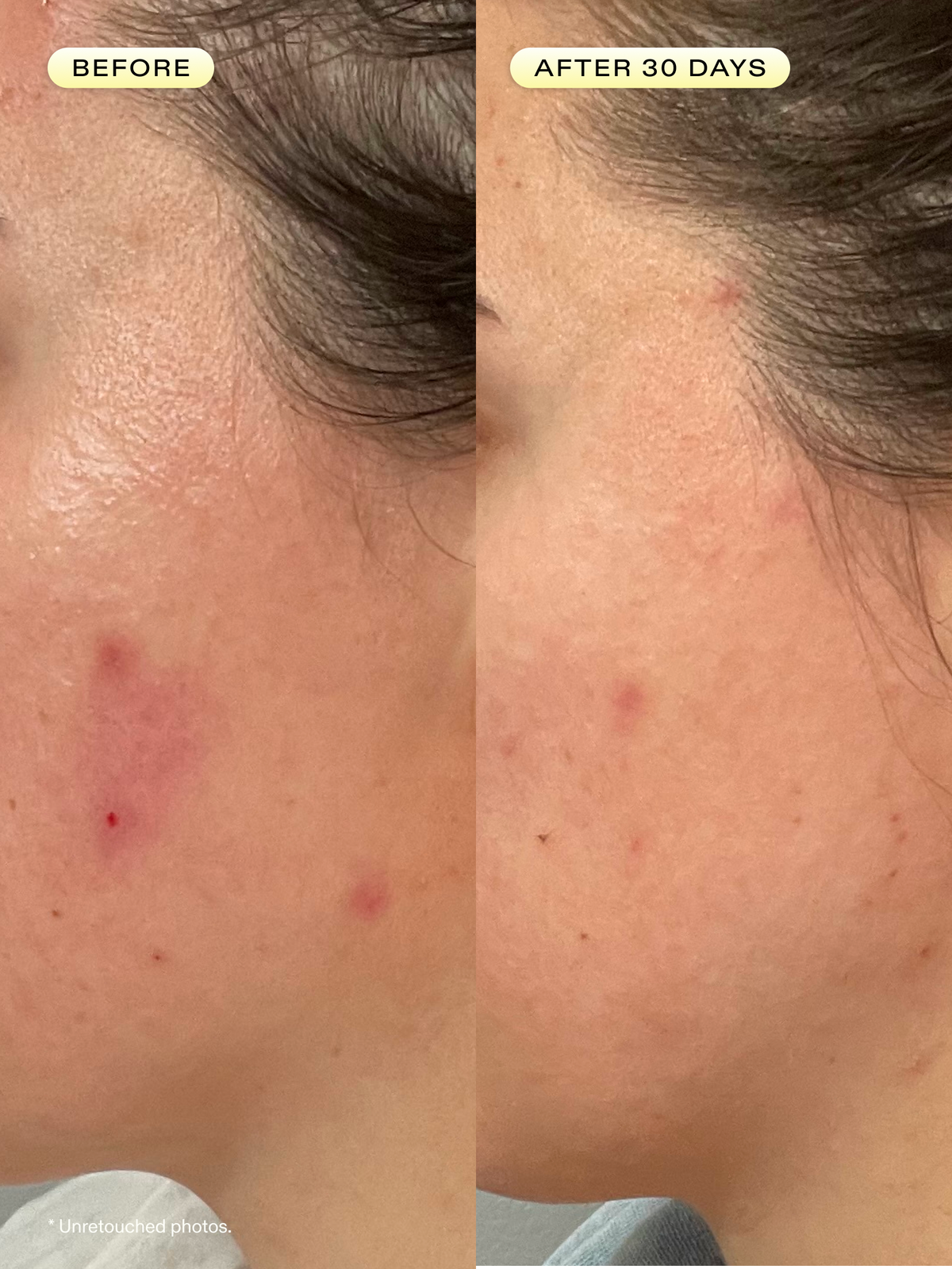 Before and after 30 days of using Oil La La